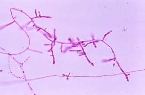 Microconidia of Trichophyton mariatii